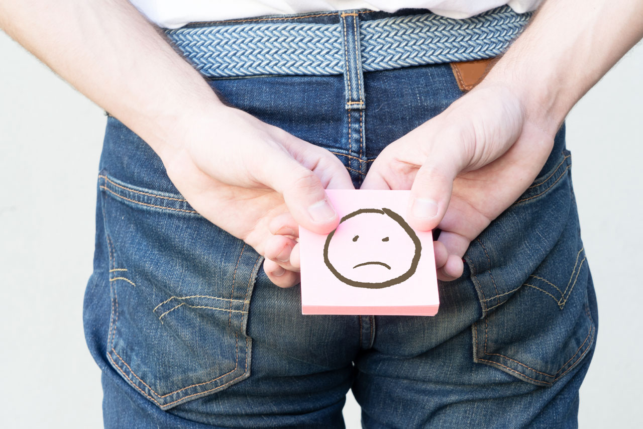 Αιμορροΐδες